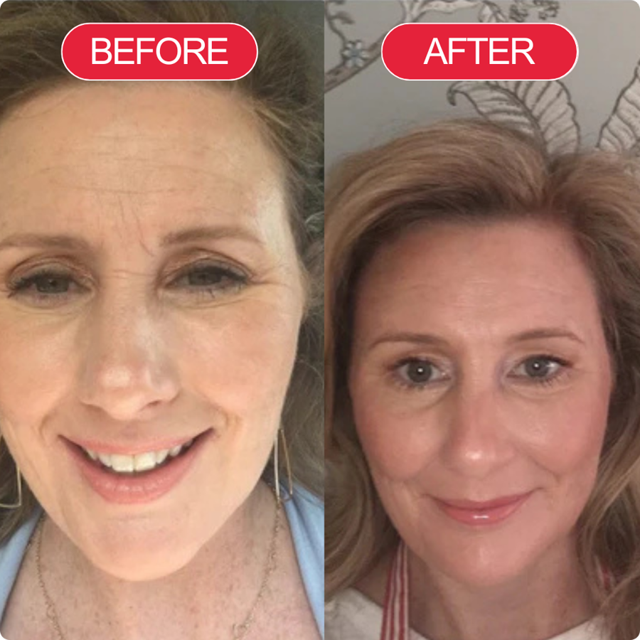 Before and after