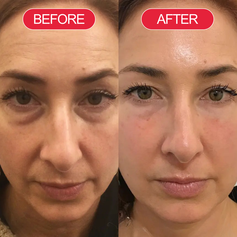 Before and after