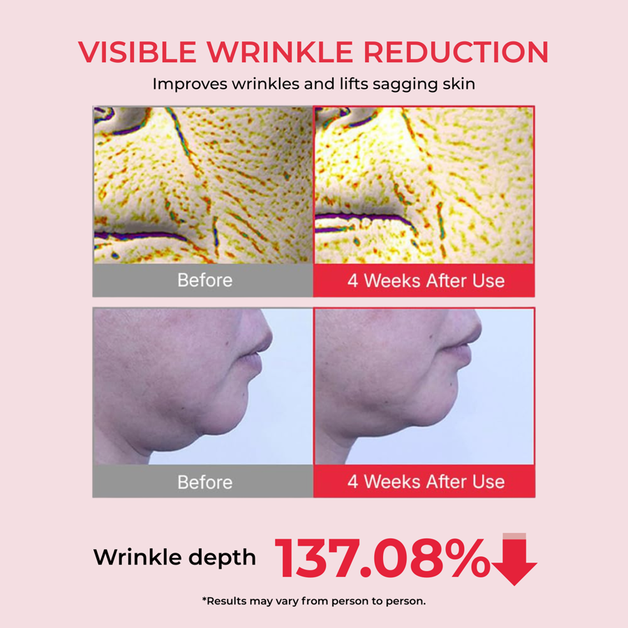 Visible wrinkle reduction: wrinkle depth 137.08% after 4 weeks